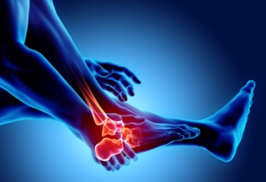 How Rheumatoid Arthritis Can Affect the Ankles